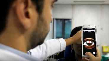 Realização de exames de retina no SUS cresce quase 50%