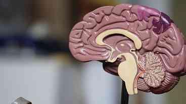Traumas na cabeça podem causar Alzheimer, diz estudo