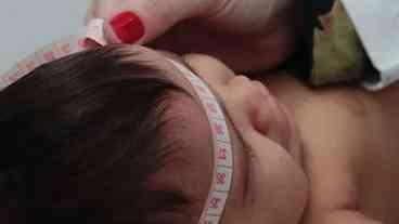 Sequestro de gene após infecção por zika causa microcefalia, diz estudo