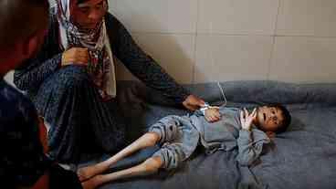 Gaza enfrenta crise de desnutrição infantil