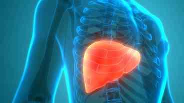 Hábitos Ocidentais e Gordura no Fígado