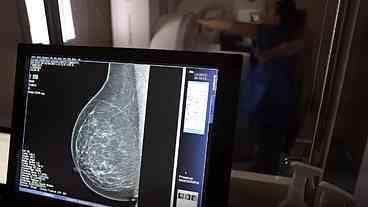 Escassez de Mamógrafos e Câncer de Mama no Brasil