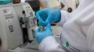 Câncer de Próstata: Cura em até 98% com Diagnóstico Precoce