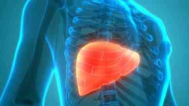 Estilo de Vida Ocidental e Gordura no Fígado