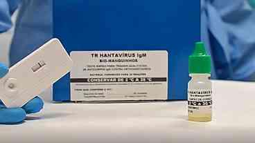 Novo teste rápido para hantavirose reduz letalidade