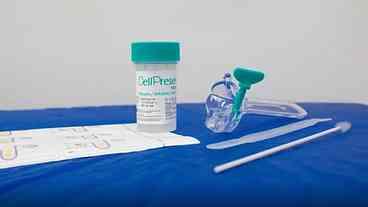 Novo Guia de Rastreamento do Câncer de Colo do Útero