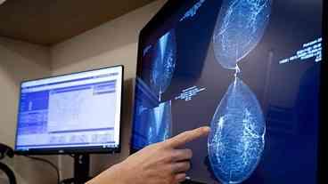 Alto Risco de Câncer na Alemanha: Dados Recentes