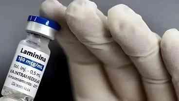Polilaminina gera esperança, mas ainda exige estudos
