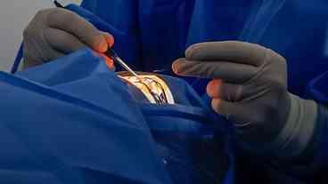 Primeiro Transplante de Córnea na Rede Municipal do Rio