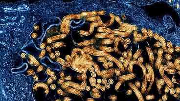OMS decreta emergência global após avanço do ebola na África