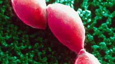 Parasita negligenciado infecta um terço da humanidade