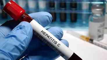 Saúde destaca liderança da Espanha contra hepatite C