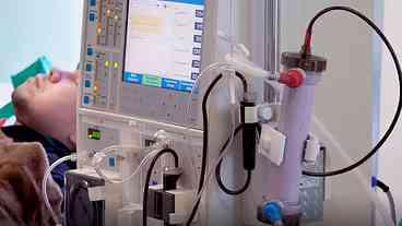 Casos de doença renal podem ser maiores no país, indica estudo