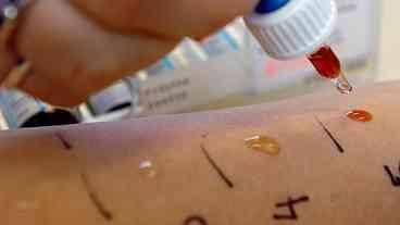 Alergia grave: quando uma reação pode colocar a vida em risco