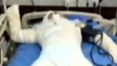 jovem-queimada.gif