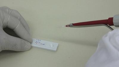 testedengue.jpg