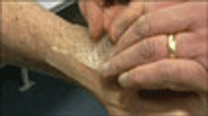 curativo1-300x168.gif