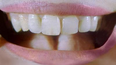 dente.jpg