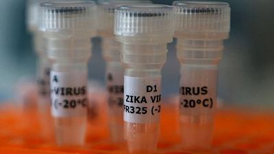zika-5.jpg
