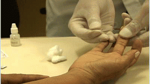 aids2-300x168.gif