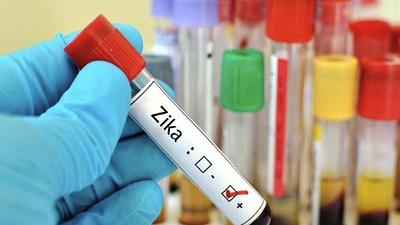 zika-2.jpg