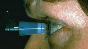 glaucoma-300x168.gif