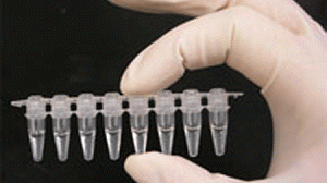 meningite-teste-300x168.gif