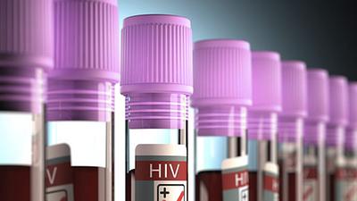 hiv-1.jpg