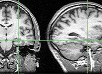 memoria-cerebro.jpg