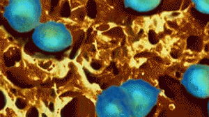 gono-300x168.gif