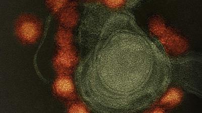 zika-2.jpg